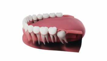 How Long Does a Typical Tooth Extraction Procedure Take?